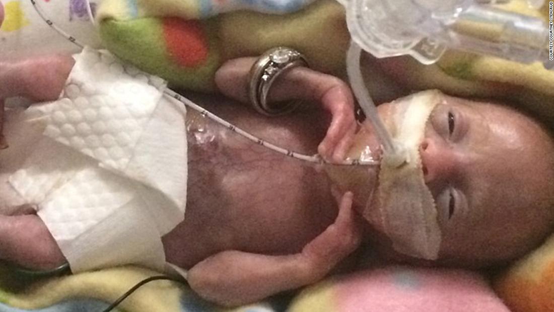 Born before 22 weeks, 'most premature' baby is now thriving