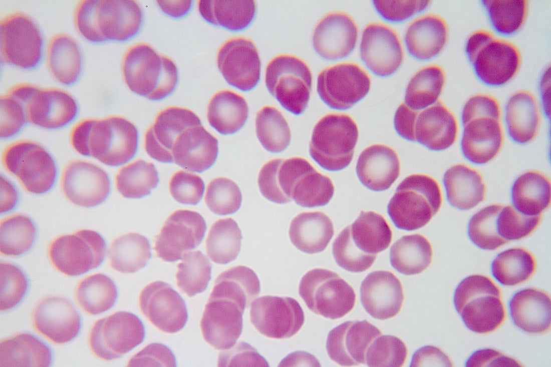 What Are the Effects of Abnormal Blood Clotting on Your Health?