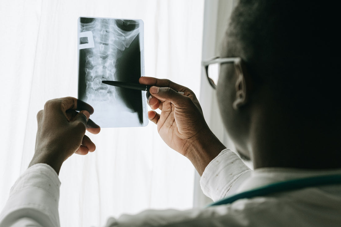 Does Osteoporosis Affect Only Women?