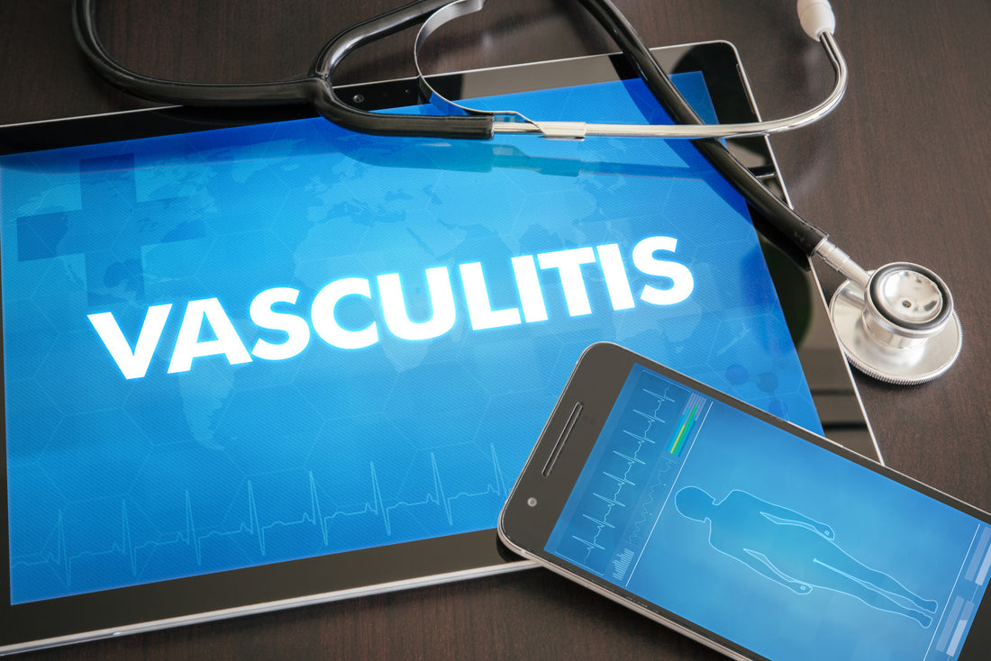 causes of vasculitis