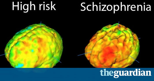 Radical New Approach To Schizophrenia Treatment Begins Trial