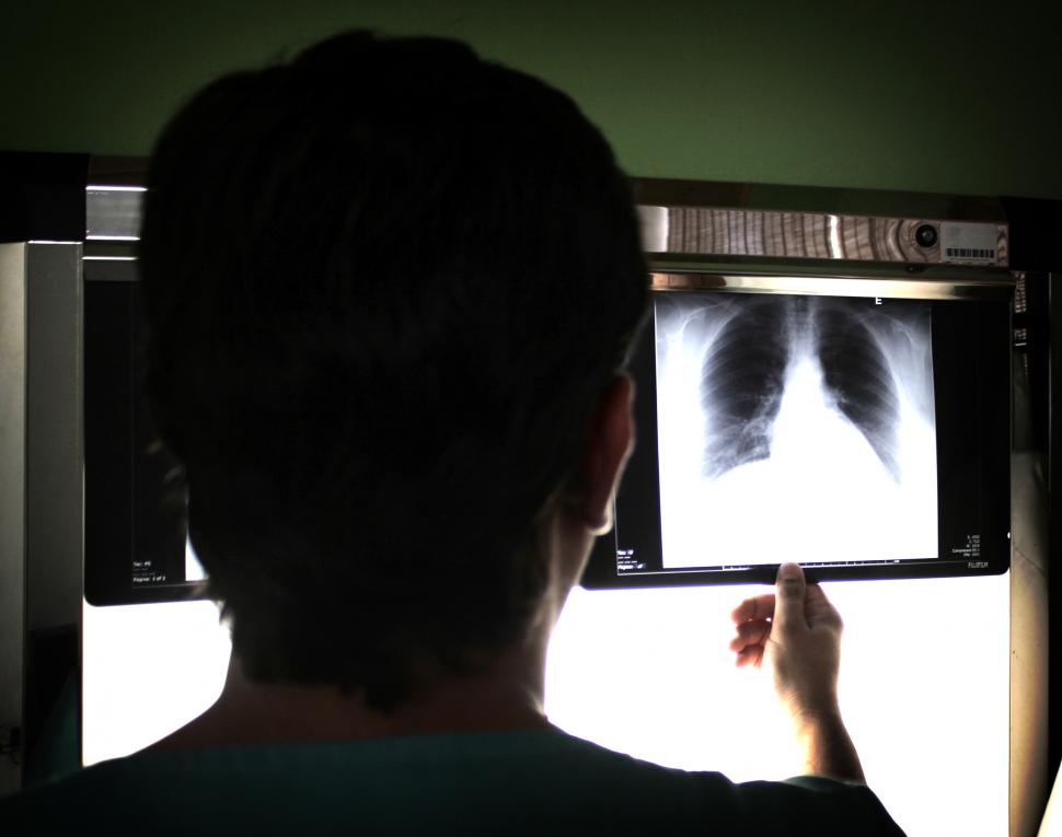 causes of emphysema